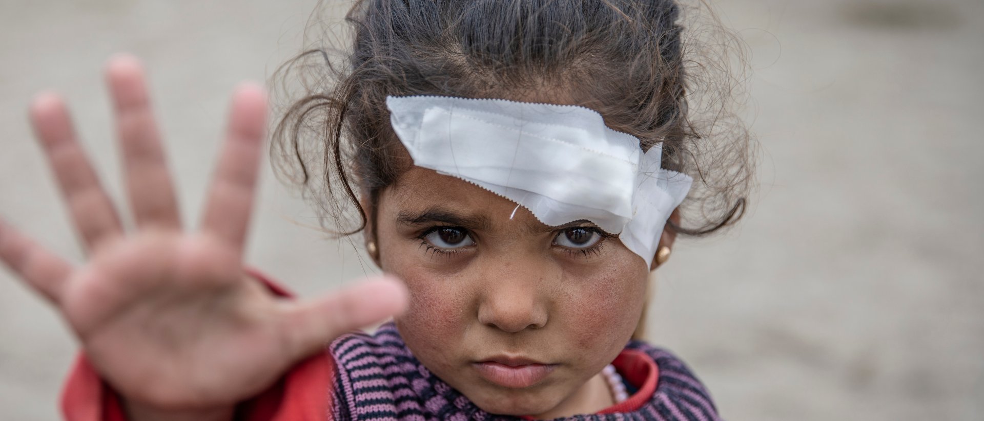 niña herida en la guerra